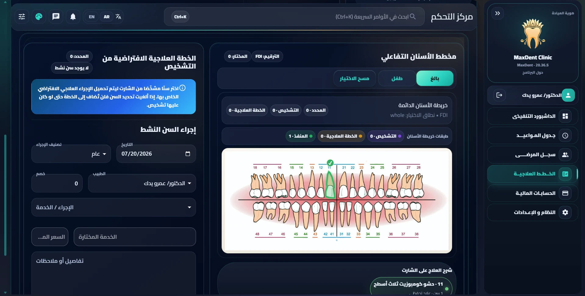 الأوندوغرام والخطة العلاجية في MaxDent